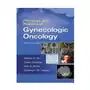 Principles and Practice of Gynecologic Oncology Sklep on-line