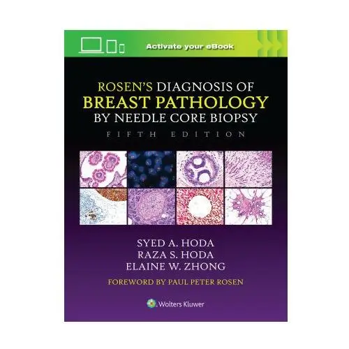 Rosen's Diagnosis of Breast Pathology by Needle Core Biopsy