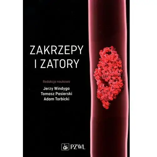 Zakrzepy i zatory