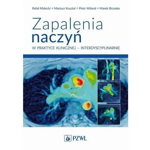 Zapalenia naczyń w praktyce klinicznej interdyscyplinarnie