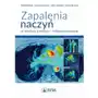 Zapalenia naczyń w praktyce klinicznej interdyscyplinarnie Sklep on-line