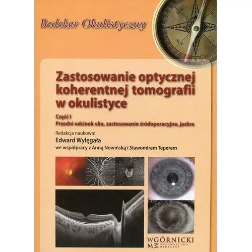 Zastosowanie optycznej koherentnej tomografii w okulistyce. Część 1. Przedni odcinek oka, zastosowanie śródoperacyjne, jaskra