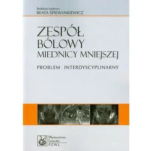 Zespół bólowy miednicy mniejszej. Problem interdyscyplinarny