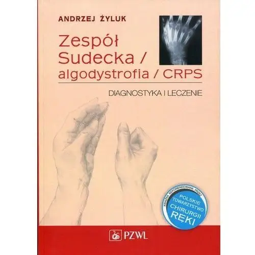 Zespół Sudecka / algodystrofia / CRPS. Diagnostyka i leczenie