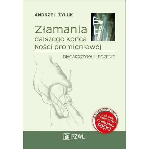 Złamania dalszego końca kości promieniowej. Diagnostyka i leczenie