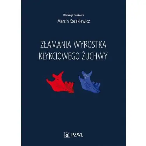 Złamania wyrostka kłykciowego żuchwy