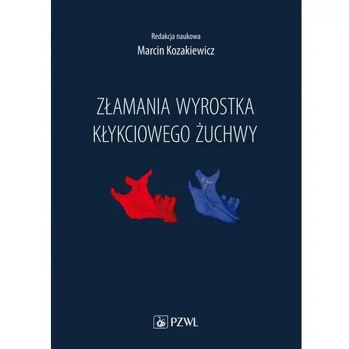 Złamania wyrostka kłykciowego żuchwy