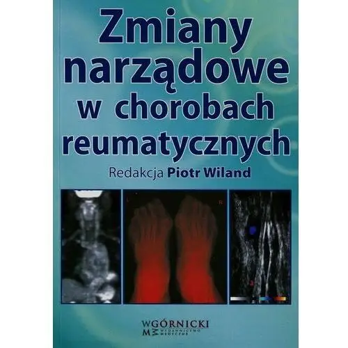 Zmiany narządowe w chorobach reumatycznych